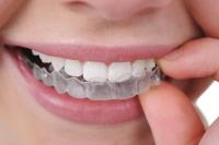 Best Invisalign treatment in Melbourne image 3